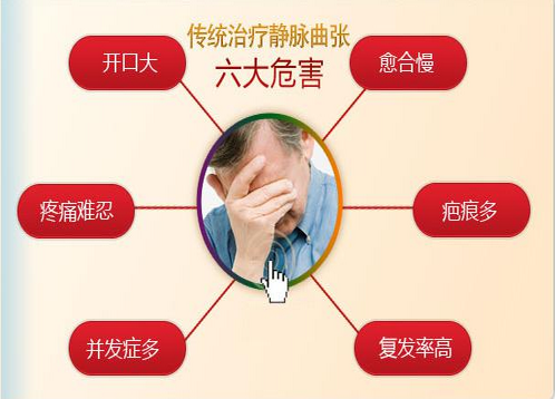 济南中医静脉曲张医院